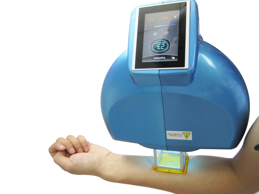 Vitiligo, псориаз, лечение дерматита, возбуждающая лазерная система Mini 308, система возбуждения, класс II 2 дня EN ISO13485