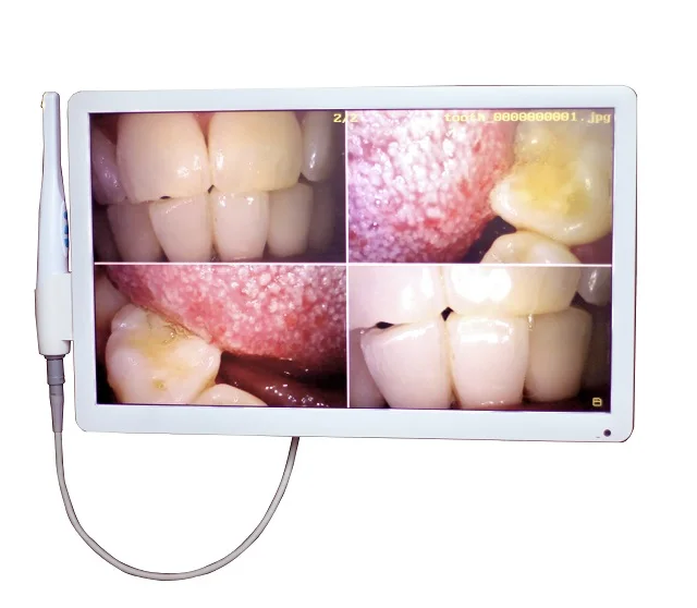 口腔内カメラ - Buy デジタル口腔内カメラ、歯科口腔内カメラ 