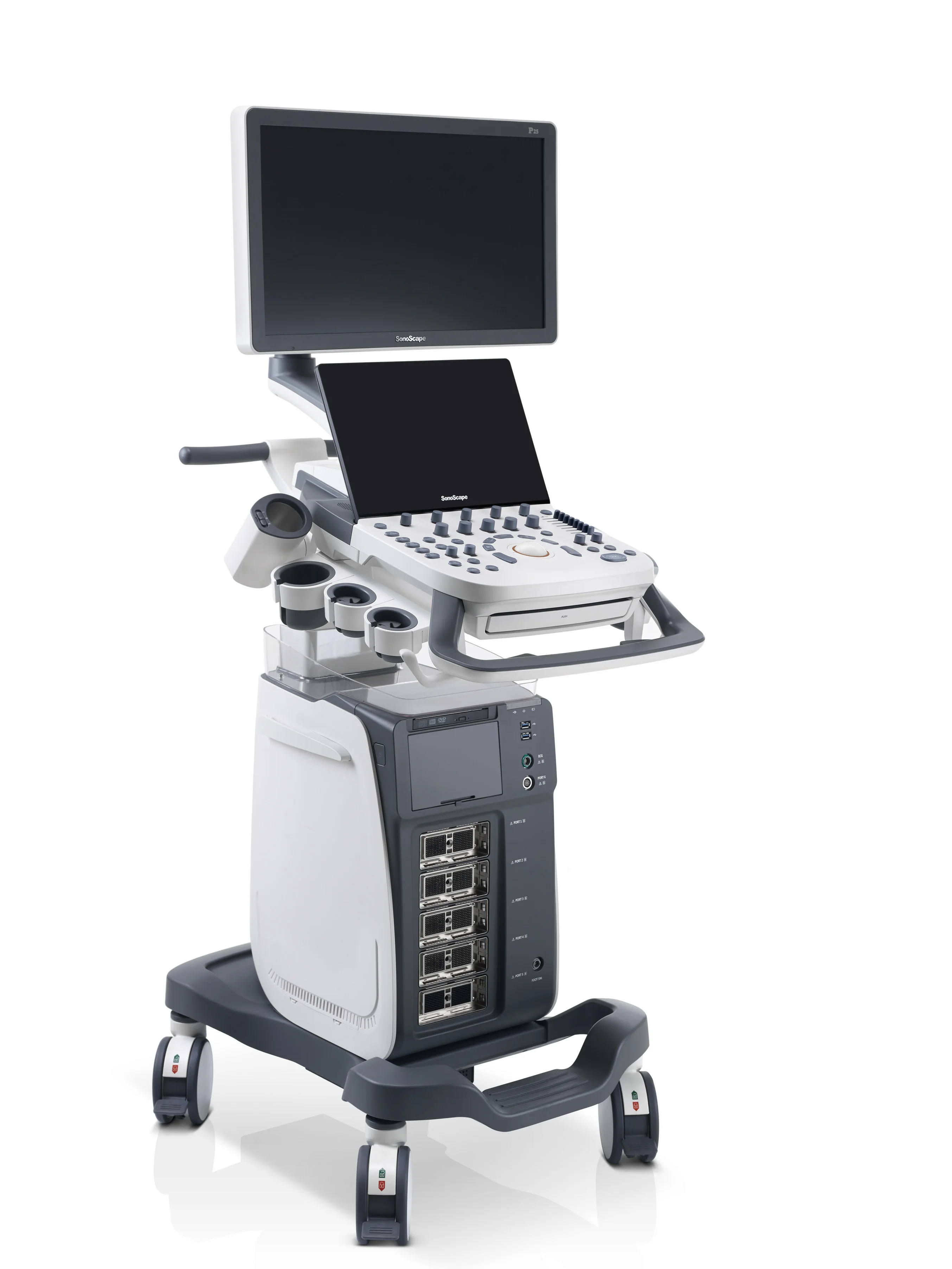 Value and Significance Sonoscape P20 Digital Color Doppler Ultrasound