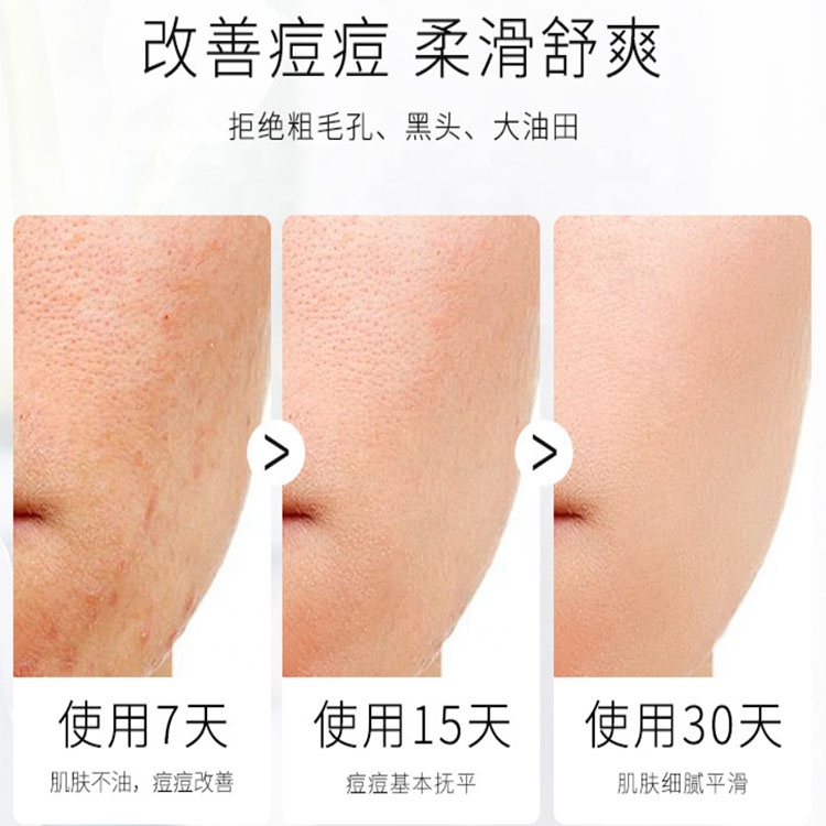 
 100% натуральное мыло, Собственная Марка, ручная работа, Глубокая очистка, управление маслом, лучшие органикаты, мыло для удаления сыра  