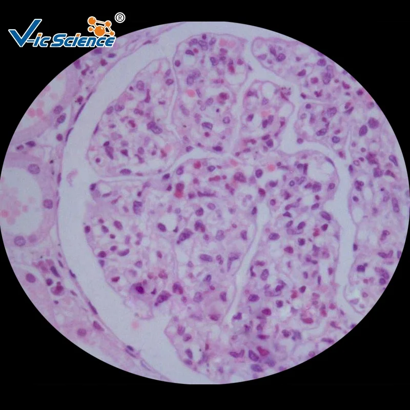 100pcs Human Pathology Prepared Slides for Medical Students Histology Slide
