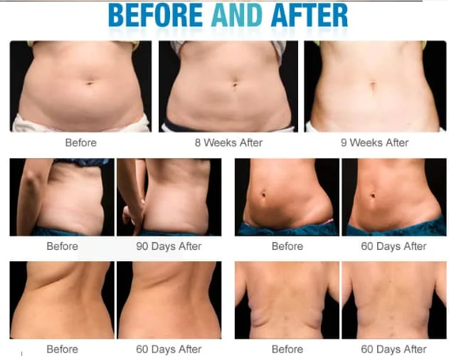 before and after