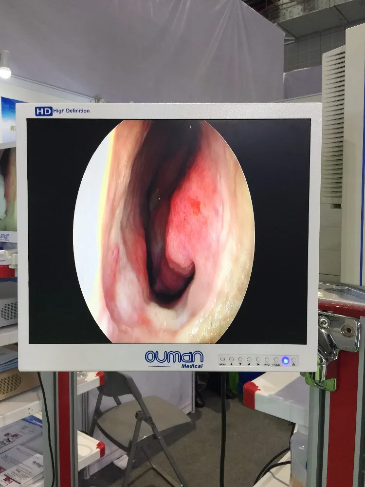 19 Inch Medical LCD Monitor for Endoscope Device