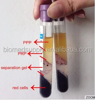 
Новинка 2019, портативная настольная центрифуга PRP для плазменной терапии Platenet Rich, легкий комплект PRP 