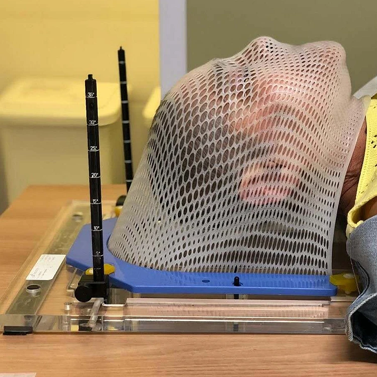radiotherapy head mask.jpg