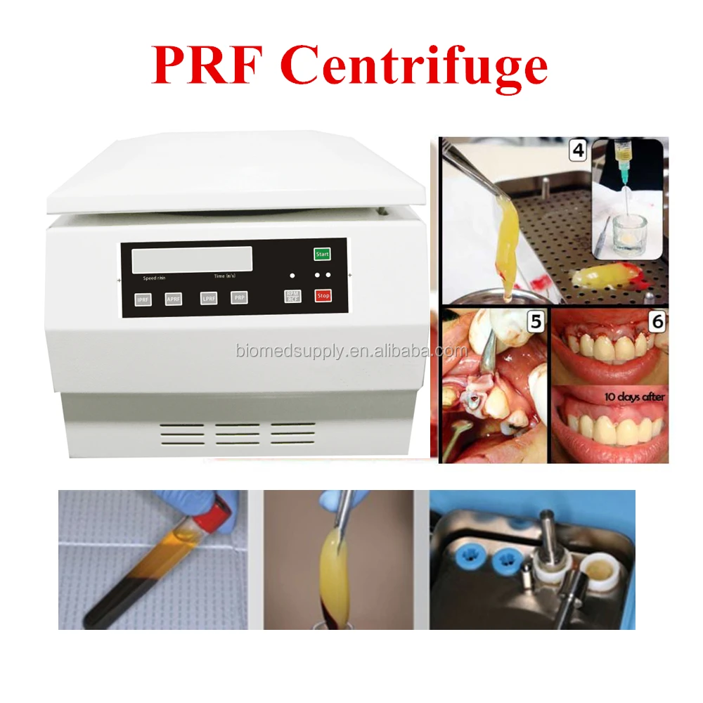 2021 Hospital Equipment PRF Centrifuge with Angle rotor 12 tubes centrifuge for dental use
