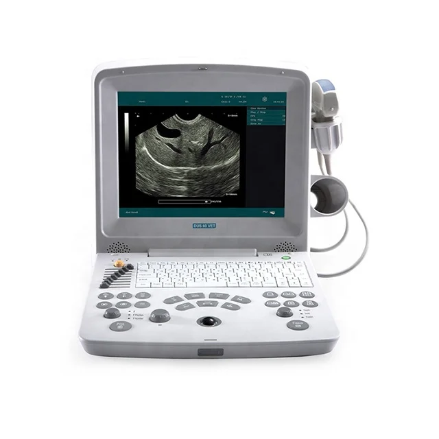Diar vet узи аппараты. Diar vet узи аппараты. Портативный узи-сканер acuvista vt98b. Edan узи. Diar vet узи аппараты.