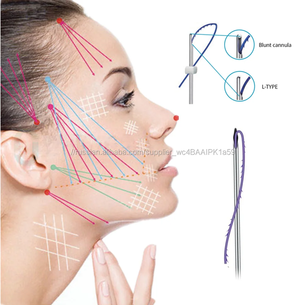 Как устанавливают нити. Lift line PDO нити. Нитевой лифтинг нитями cog (4d) канюля PDO. Нити 4d Lift 3. Нити Аптос для подтяжки лица схема.