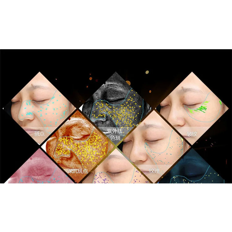 2019 Good Price Visia Skin Scanner Analyzer/visia Complexion Analysis