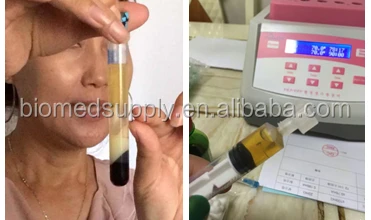 PRP Skin care New Advanced Pink PPP gel maker with 4size filling syringe machine