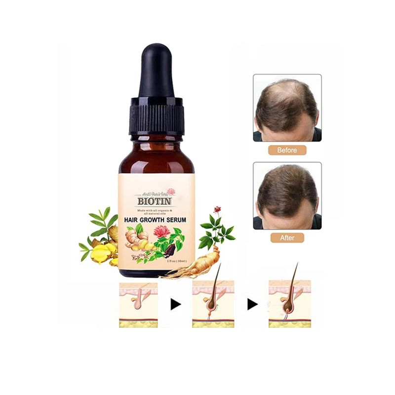 Buy Satthwa Redensyl  Biotin Hair Growth Serum For Hair Fall Controls  Thicker Fuller and Stronger Hair For Women  Men 50ml Online at Low  Prices in India  Amazonin