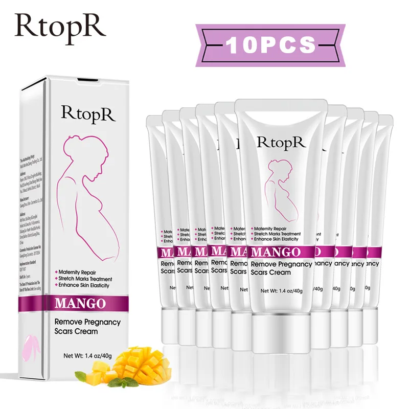 rtopr mango stretch mark cream
