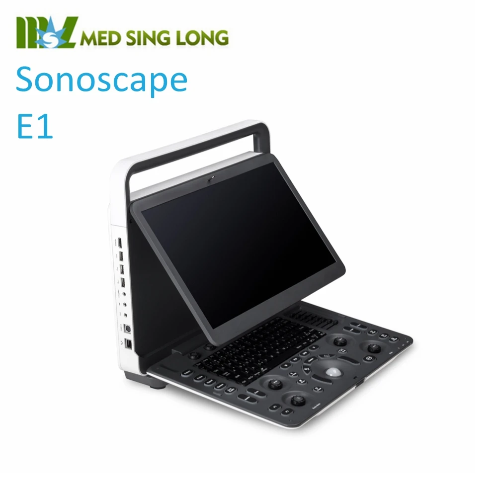 18 Cheapest Sonoscape E1 Portable Ultrasound Scanner Human Veterinary View Portable Ultrasound Msk Sonoscape Product Details From Medsinglong Co Ltd On Alibaba Com