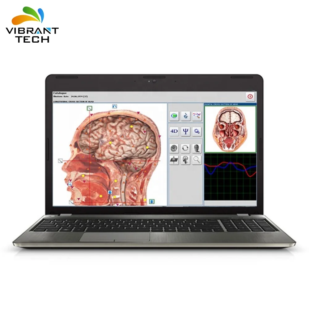 Расширенный 4025 nls Охотник Bioresonance устройство с бесплатной доставкой; Metatron nls мета 4025 Hunter