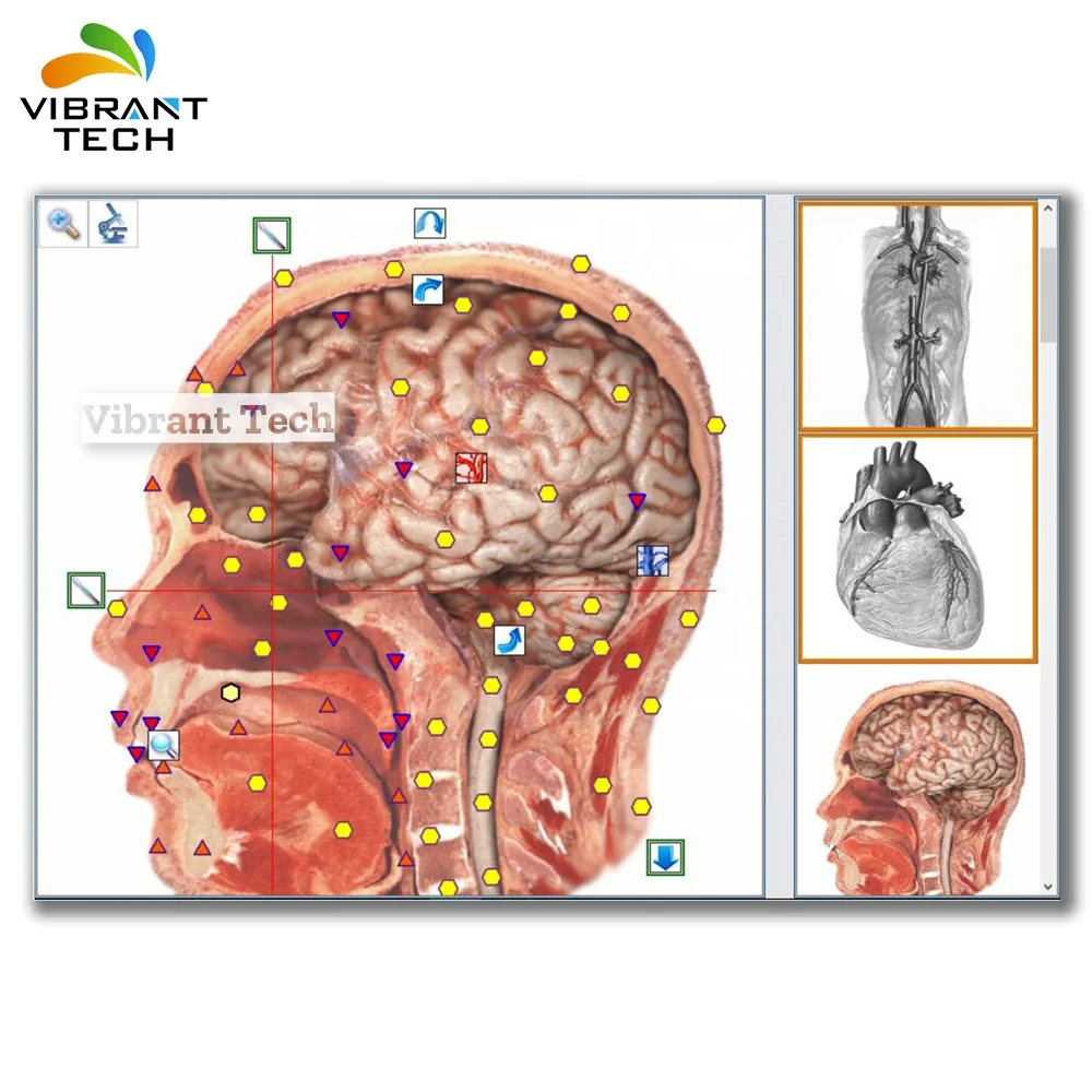 Bioresonance Health Scan and Therapy NLS Metatron Hunter 4025