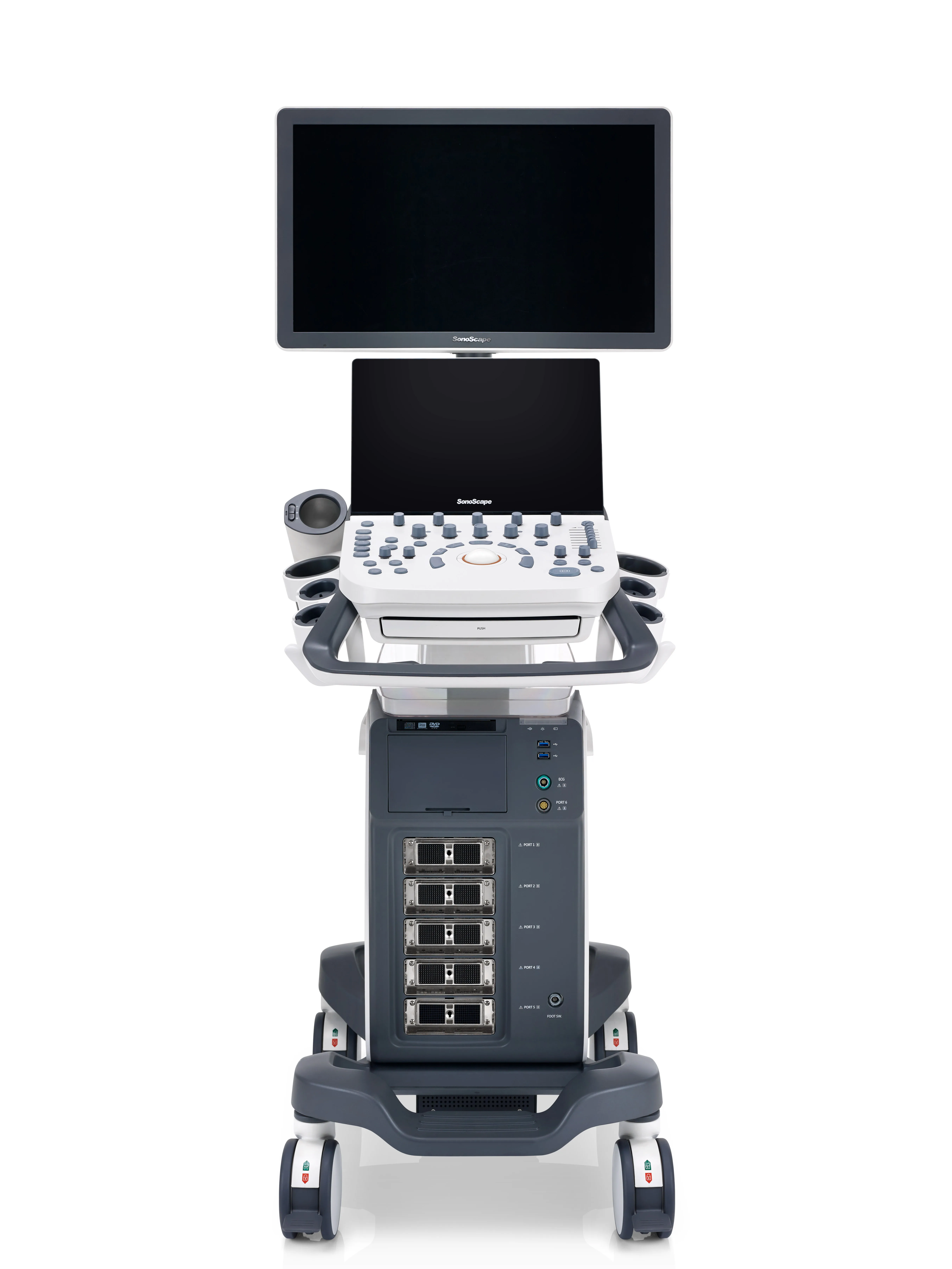 Value and Significance Sonoscape P20 Digital Color Doppler Ultrasound