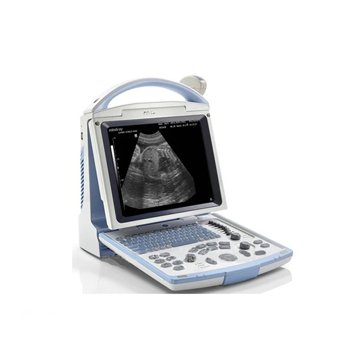 mindray portable cheap ultrasound machines dp-10 with best price
