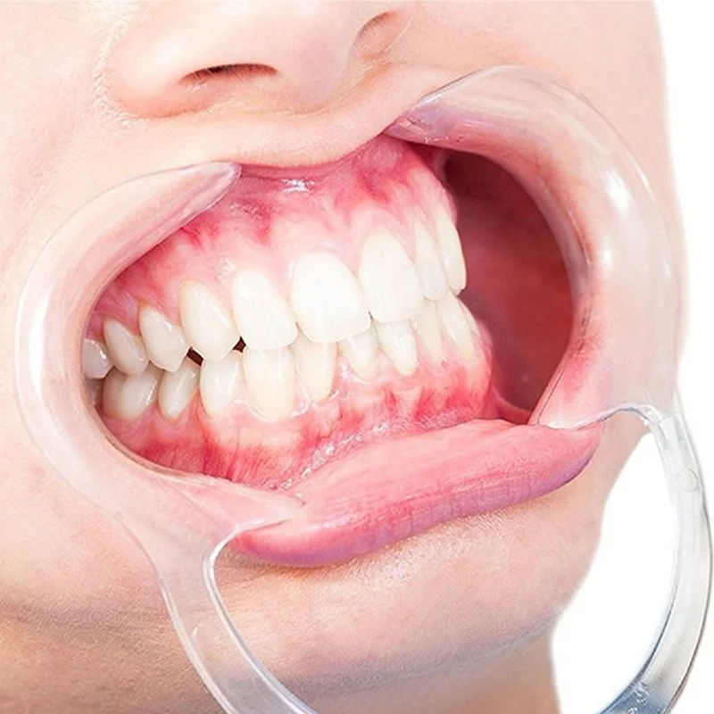 Рот устает. Ретрактор стоматологический силиконовый. Ретрактор расширитель стоматологический. Расширитель для рта стоматологический. Стоматологическая распорка для рта.