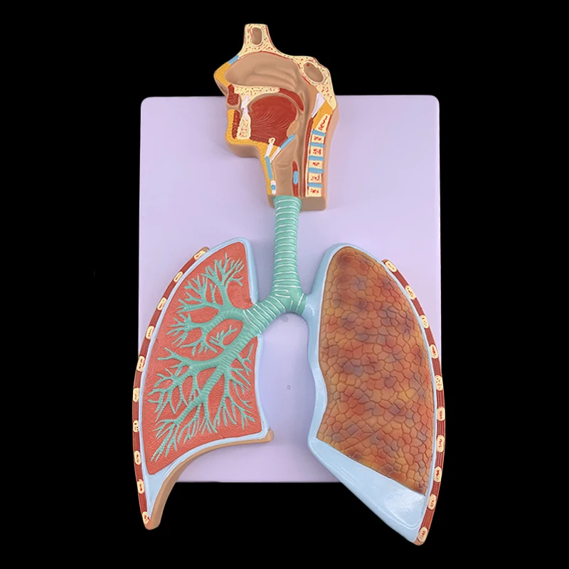 Sistema Respiratorio Humano De Plástico 3d,Modelo De Laringe Con Alveolo  Magnificado - Buy Modelo De Pulmón Con Laringe,Modelo De Enseñanza De  Pulmón,Modelo De Anatomía De Los Pulmones Product on 