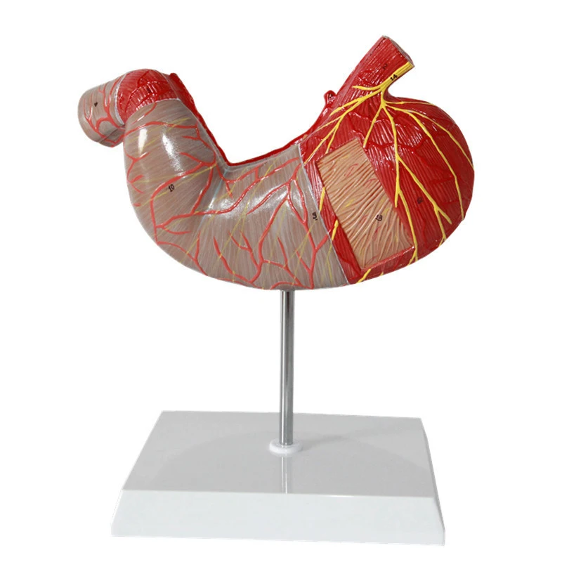 5 倍大型人体胃解剖模型
