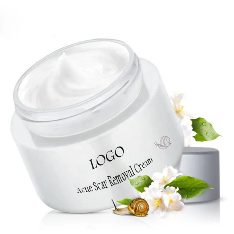 Repairing moisturizing cream. Крем Snail repairing Cream. Acne крем. Snail Essence Moisturizing Cream. Beauty face Anti acne Cream Турция.