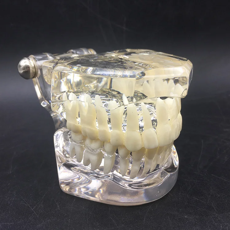 帶牙套的正畸牙齒支架模型 - buy orthodontic tooth model with