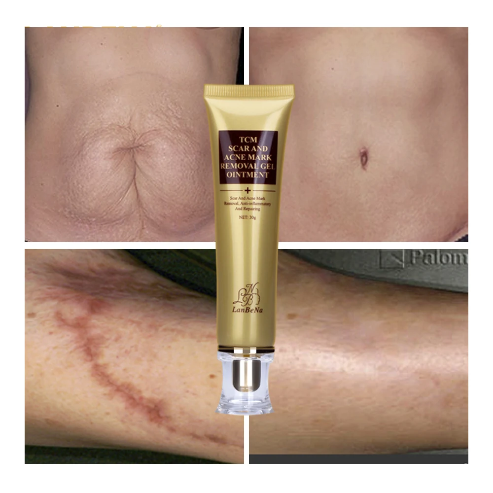 best creams for scars removal