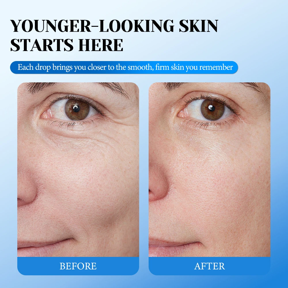 does ghk cu get rid of wrinkles GHK-Cu Copper Peptide Serum SNAP-8 Anti Aging Skin Repair Wrinkle Smoothing  Professional Facial Serum Smooths Fine Lines