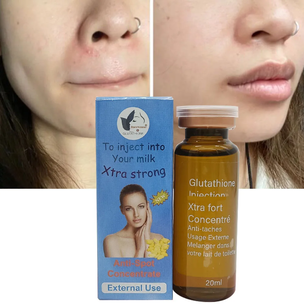 glutathione external use Glutathione for the skin main image 0