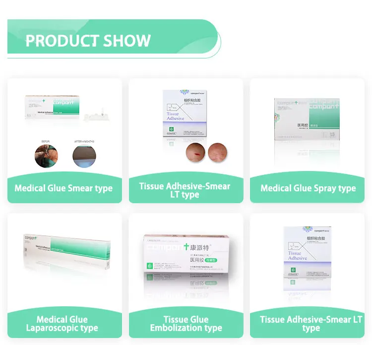 Tissue Glue Medical Wound Nbutyl2cyanoacrylate Tissue Adhesive Glue