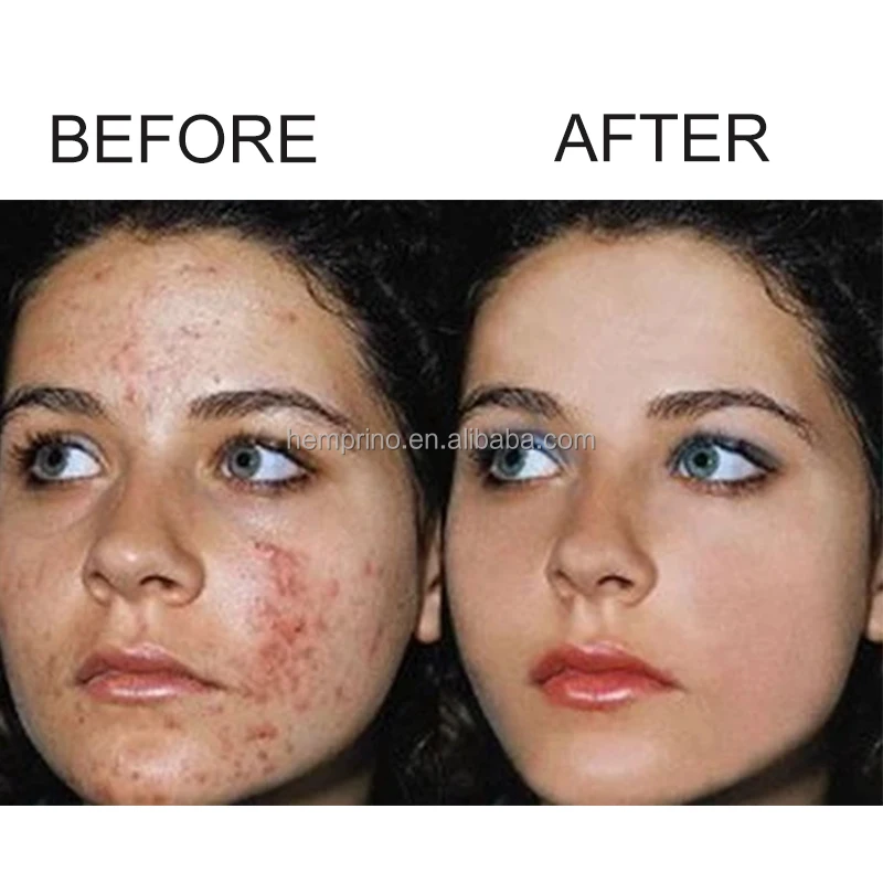 2022 OEM Private Label L-glutathione Capsules GSH Softgels Natural Skin Whitening Anti-Aging Support