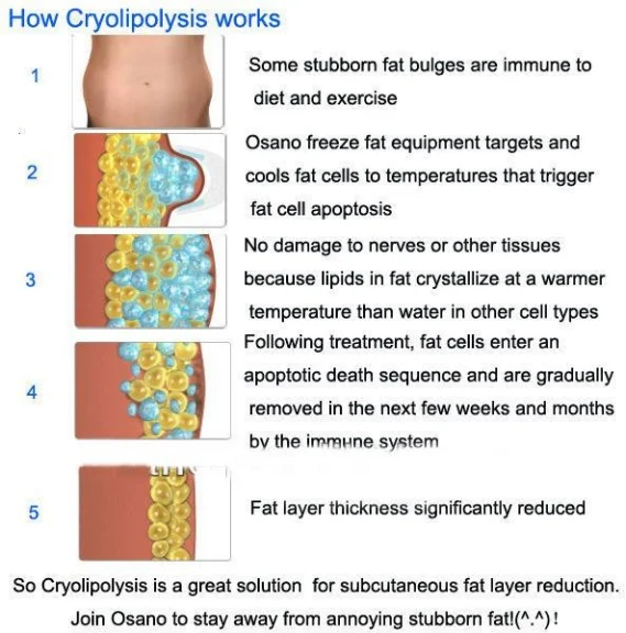 green 360 degree cryolipolisis machine cryotherapy slimming machine