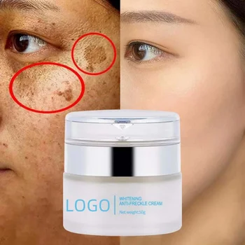 Cosmetics Care Freckle Removing Facial Cream Lotion Natural All Purpose Anti-Aging Skin Whitening Face Cream