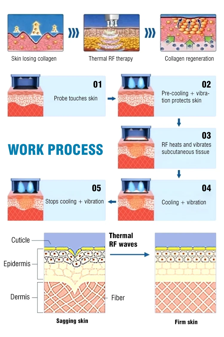 High Quality Faster Treatment Thermal Eye Body Face Rf Skin Lifting