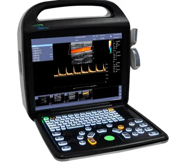 DZ-C80 Doppler Color Ultrasound System Portable Hospital Scanning Diagnostic Equipment Ultrasound system