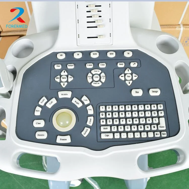 Digital Trolley Ultrasound Scanner Digital Trolley Ultrasound Scanner