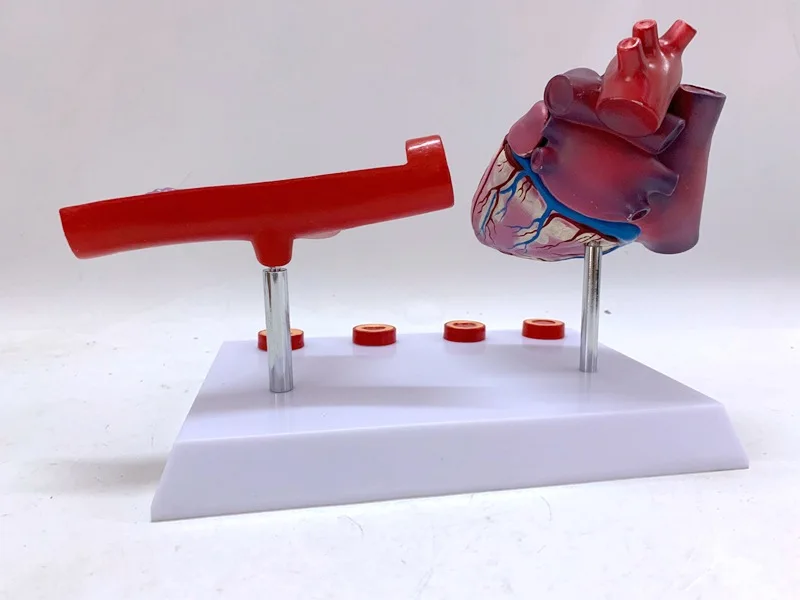 Human Anatomy Heart Model Coronary Artery Bypass And Vascular