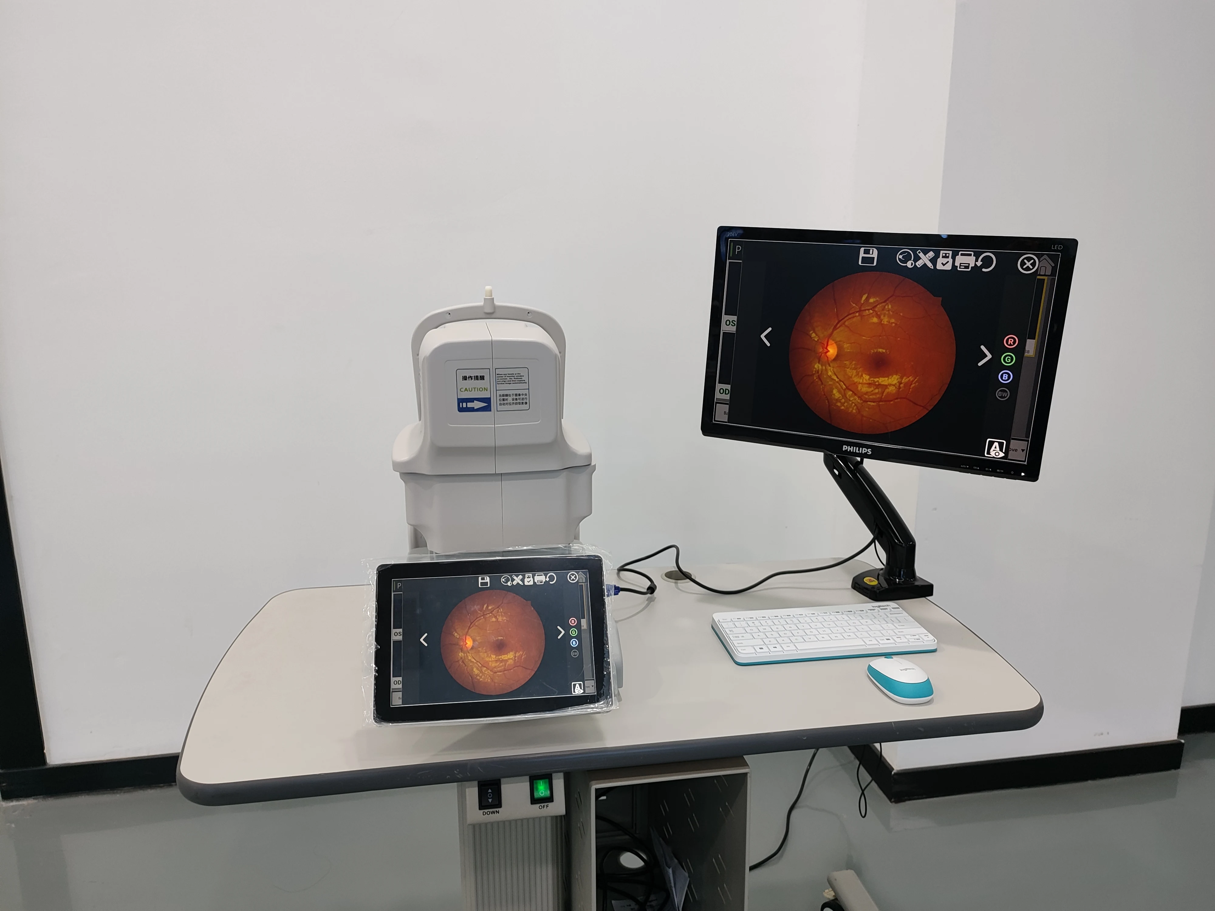 Automatic Chinrest Adjusting Cheapest and Fastest Kestrel 3100M Non-mydriatic Automatic Fundus Camera