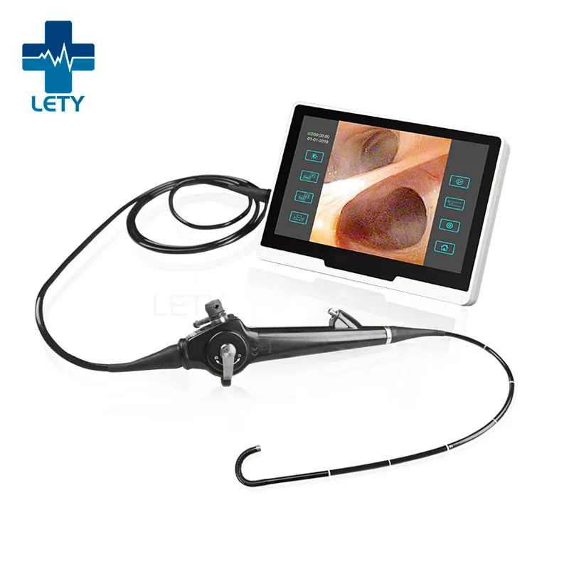 Flexible Video Choledochoscope Gallbladder endoscope In The treatment Of Cholecystolithiasis