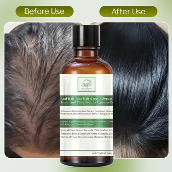 China Hair Grow Products For Scalp Treatment Improve Hair Growth Oil Serum For Men And Women