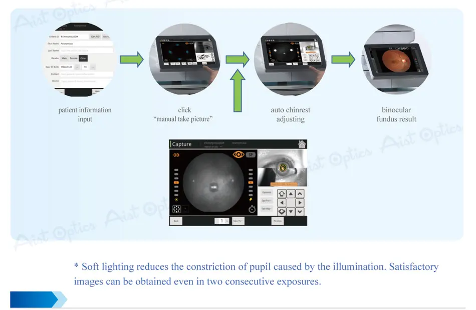 Reticam-3100 Ophthalmic Non-mydriatic Automatic Digital Retinal Fundus Camera