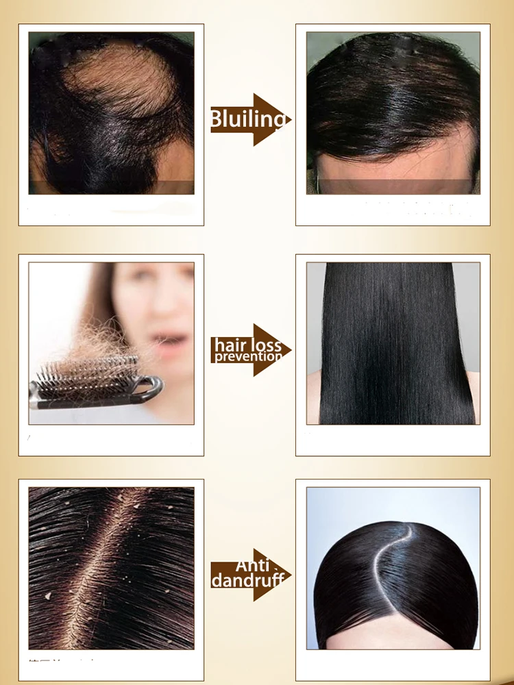 
 Фирменный натуральный травяной экстракт имбирного шампуня против выпадения волос, высококачественный травяной экстракт имбирного шампуня  