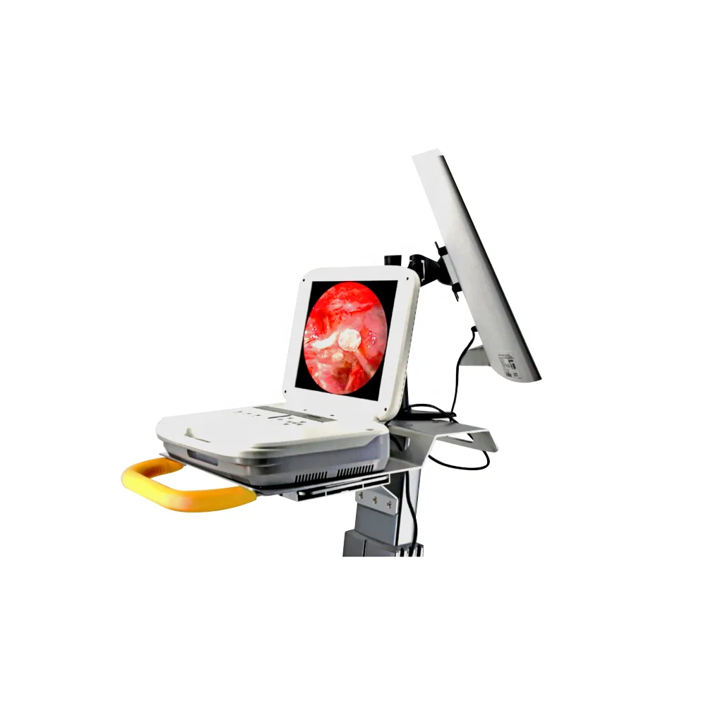Surgical endoscope FHD (display + camera system + maneggiare) endoscopy camera system  neurosurgery ent