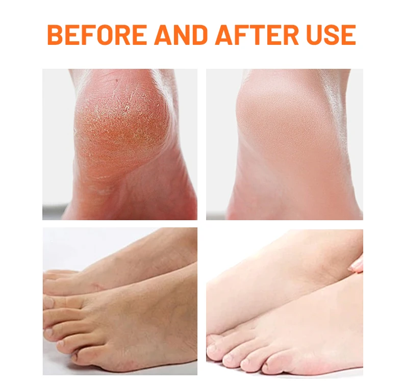 Factory Papaya Foot Peeling Mask Sock Niacinamide Extract Foot Crack Skin Care Moisture Foot Exfoliating Peel Mask