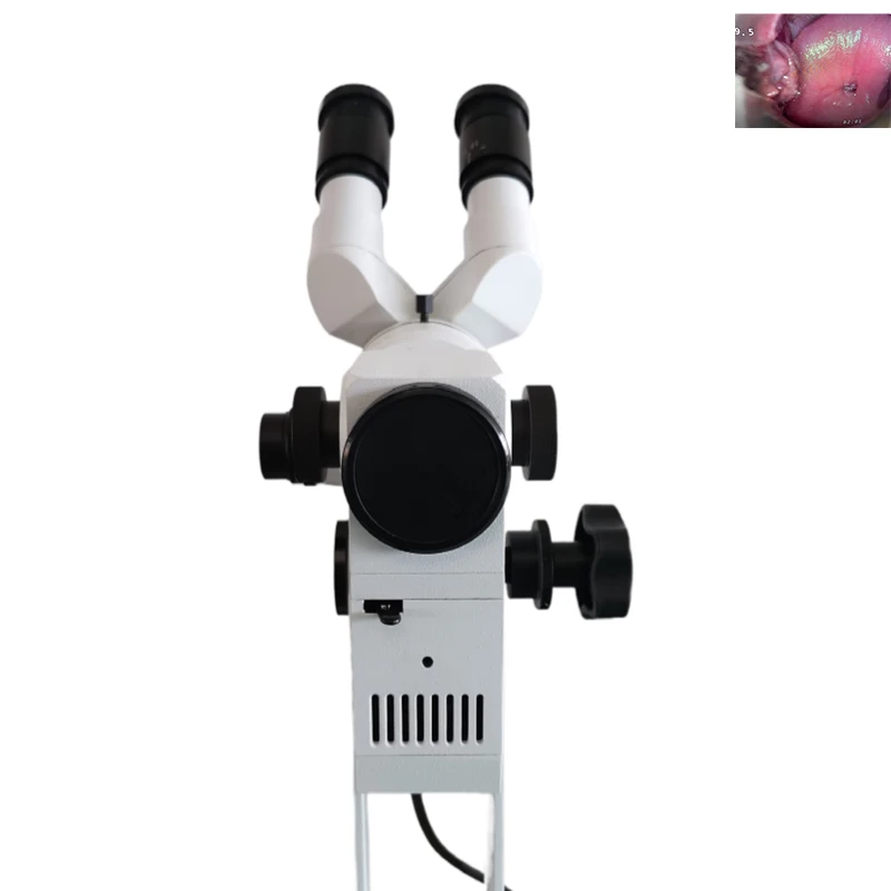 Kernel Binocular Optical Colposcope Gynecologic Vaginal Examination Microscope for Gynecologists with Cold Light Camera