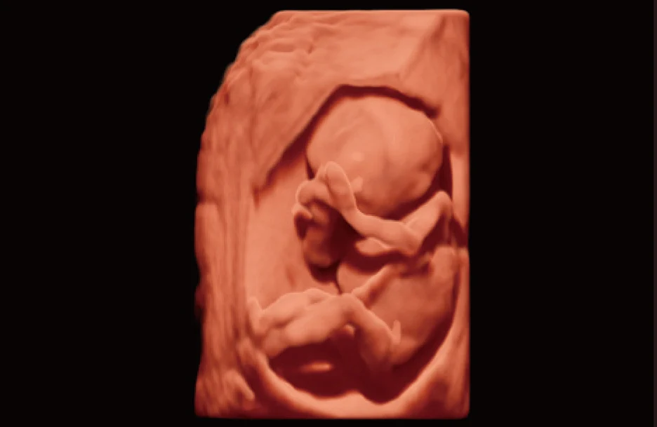 Sonoscape P20 Mobile 3D/4D Real-time Color Panoramic Doppler Trolley Ultrasound Machine supplier