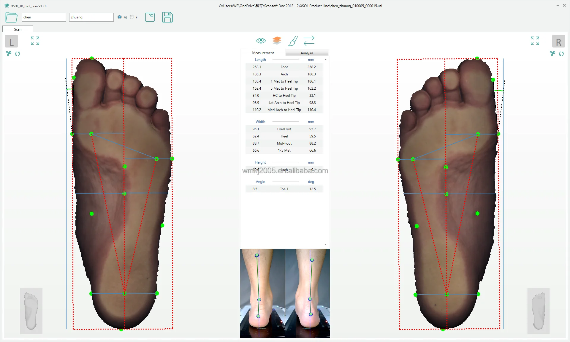3d Foot Scanner Xsol Orthotic Custom Insoles Cad 3d Printer