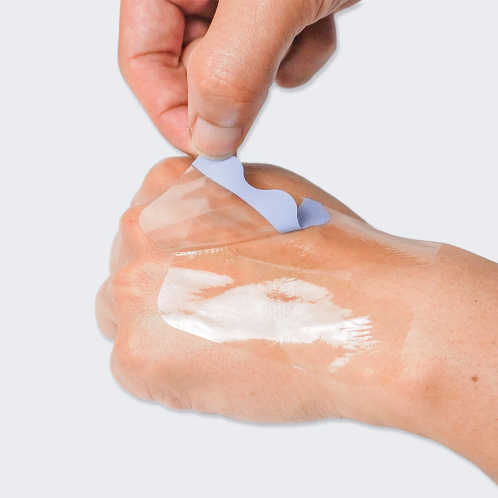 Transparent Film Dressing, Picture Frame Style, Adhesive Tape Pads for IV Catheters, Post-Surgical, Medical Appliance
