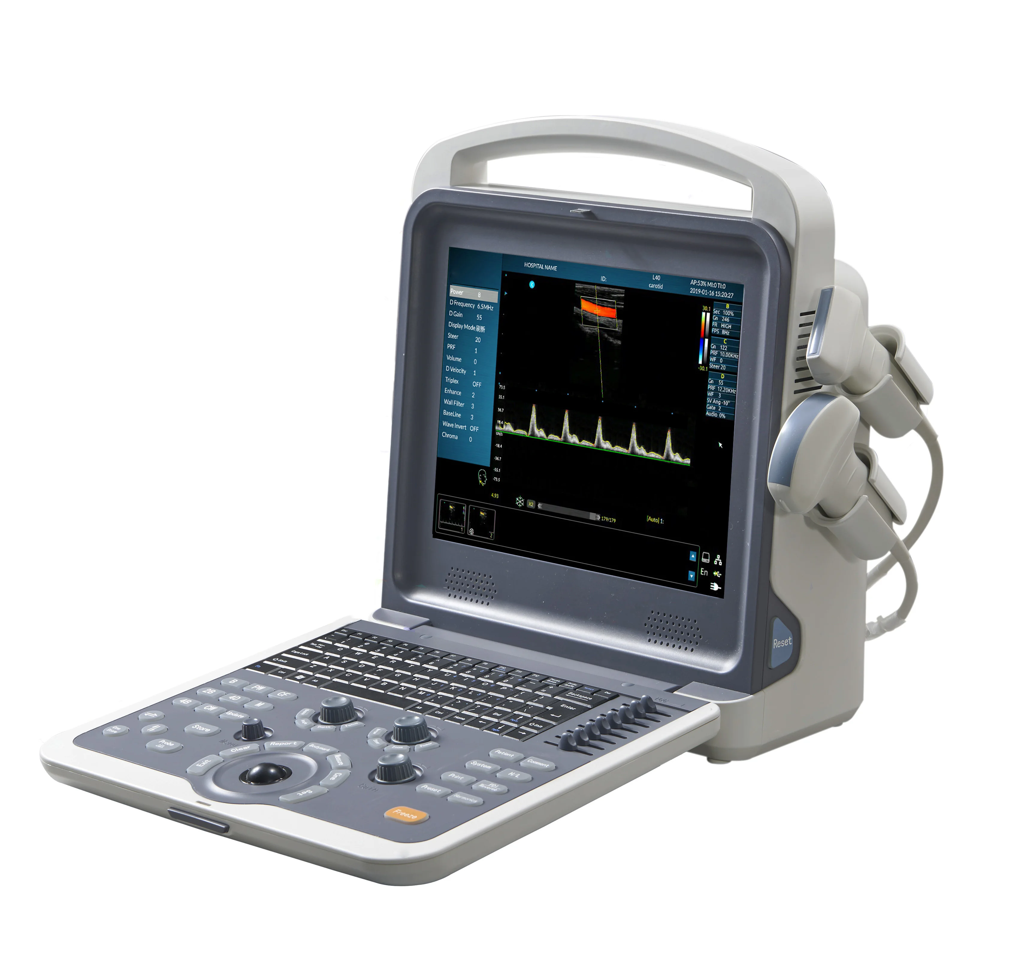 Real-Time Panoramic Image Pulsed Ultrasound Low Frequency Medical Ce Convex Ultrasound Probe Voluson E8 m Ultrasound 3D