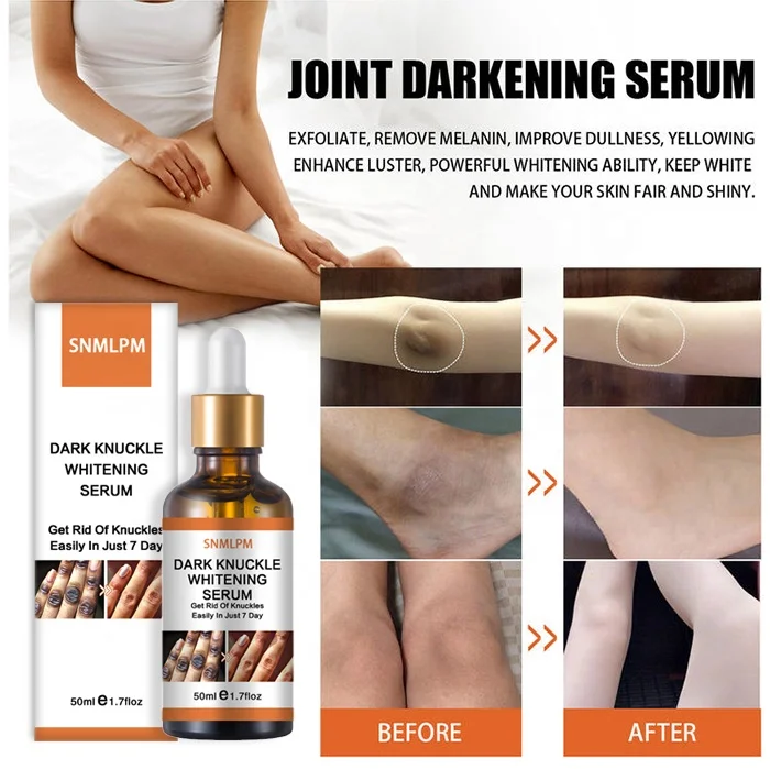 SNMLPM Whitening Dark Knuckle Serum Intense Knuckle Removal Whitening Removing Dark Knuckles Serum for Elbow and Knee